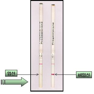 진단키트의 결과판정